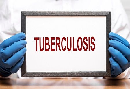 TB Alliance Loses Patent Fight for Six-Month Cure in India TB Alliance Loses Patent Fight for Six-Month Cure in India India Pharma Outlook