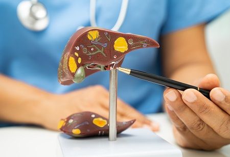 The Trial That Could Reshape Zydus' MASH Story The Trial That Could Reshape Zydus' MASH Story India Pharma Outlook