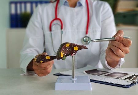 Novartis MS Pill: How does Rhapsido avoid liver toxicity? Novartis MS Pill: How does Rhapsido avoid liver toxicity?, India Pharma Outlook