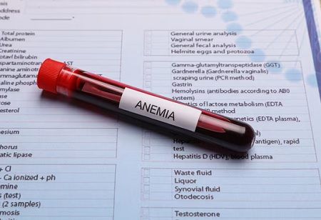 Government Strengthens Anaemia Fight With New 7x7x7 Strategy Government Strengthens Anaemia Fight With New 7x7x7 Strategy, India Pharma Outlook