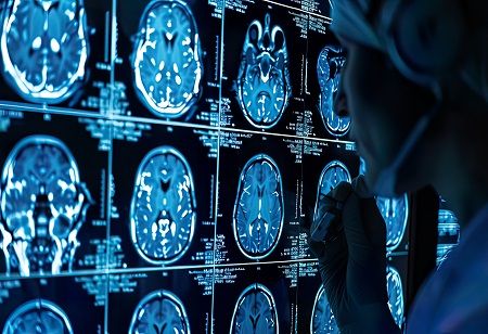 16.9 Million By 2036: Why India Needs A Dementia Care Ecosystem Now 16.9 Million By 2036: Why India Needs A Dementia Care Ecosystem Now India Pharma Outlook