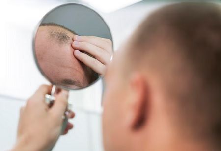 Cosmo's Male Hair Loss Treatment Delivers Sustained Growth Over Time male hair loss treatment, India Pharma Outlook